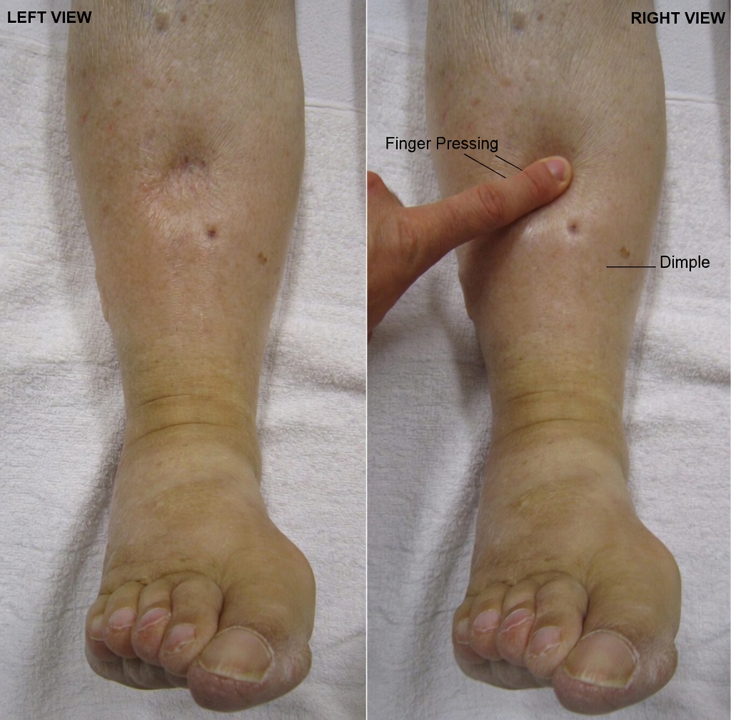 What Are the 12 Most Common Amlodipine Side Effects and Everyday Habits That Can Make a Difference?