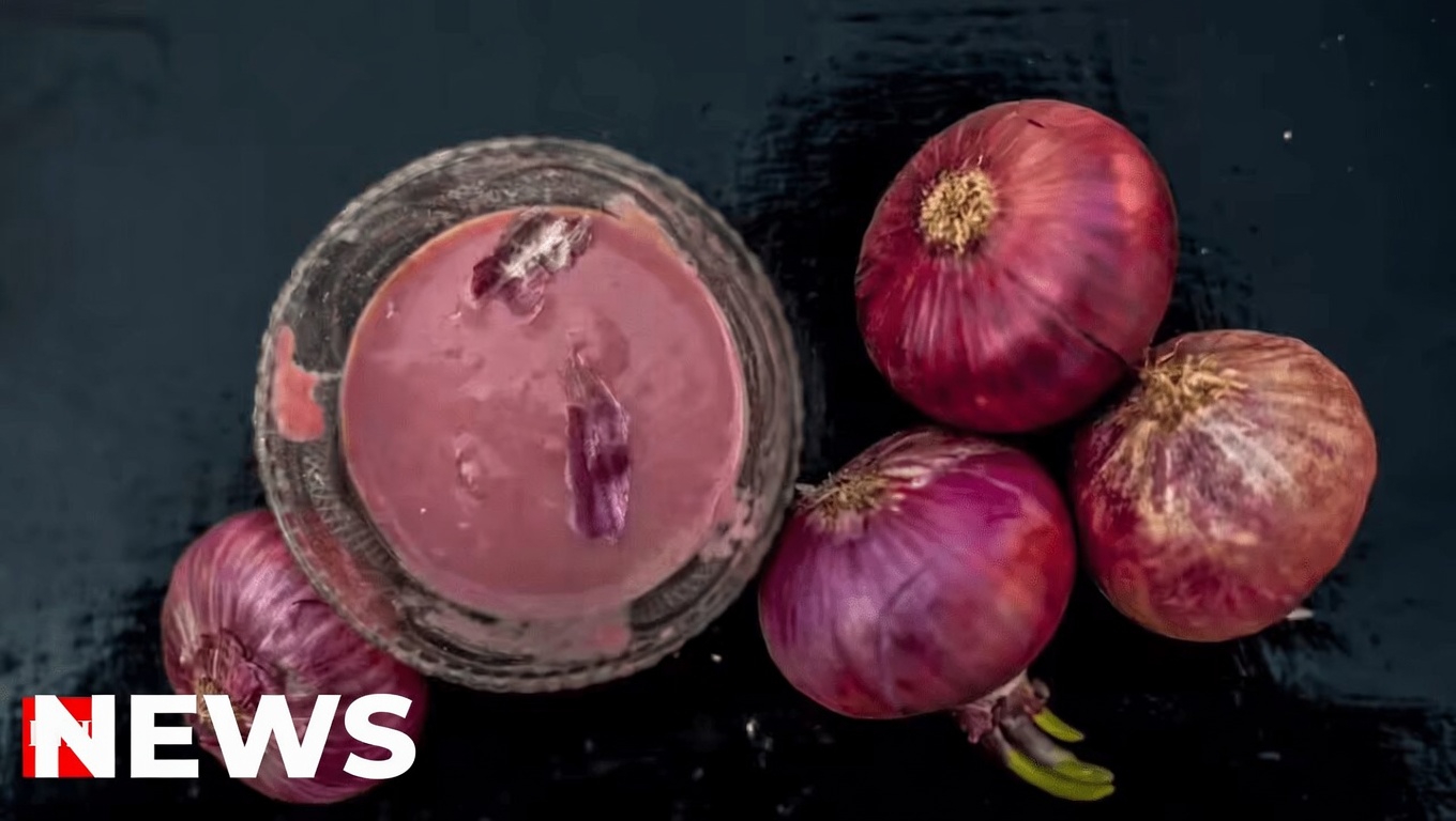 How to Use Onion and Its Peel to Support Healthy Prostate and Bladder Function Naturally