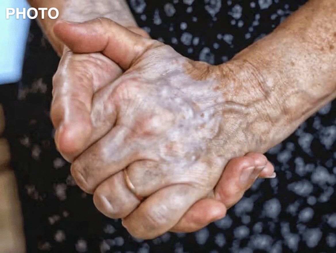 Why Are the Veins on Your Hands Becoming So Visible? Exploring Common Causes and Helpful Insights