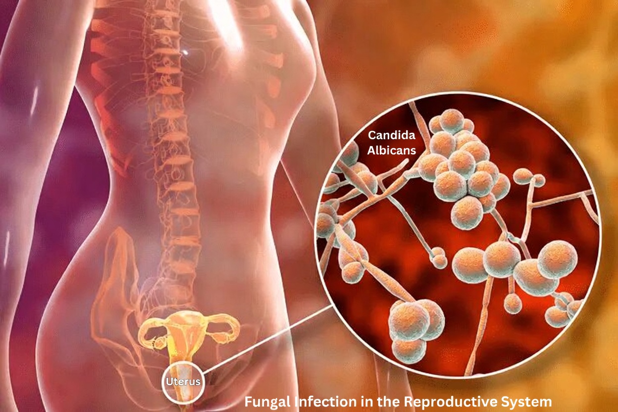 What Are the Common Signs of a Vaginal Yeast Infection Every Woman Should Know About?