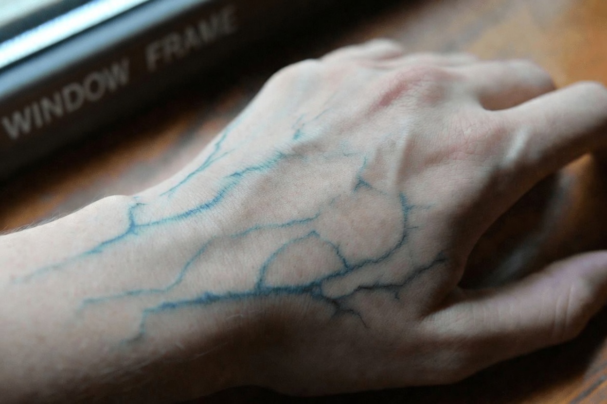 Why Are the Veins on Your Hands Becoming So Visible? Exploring Common Causes and Helpful Insights