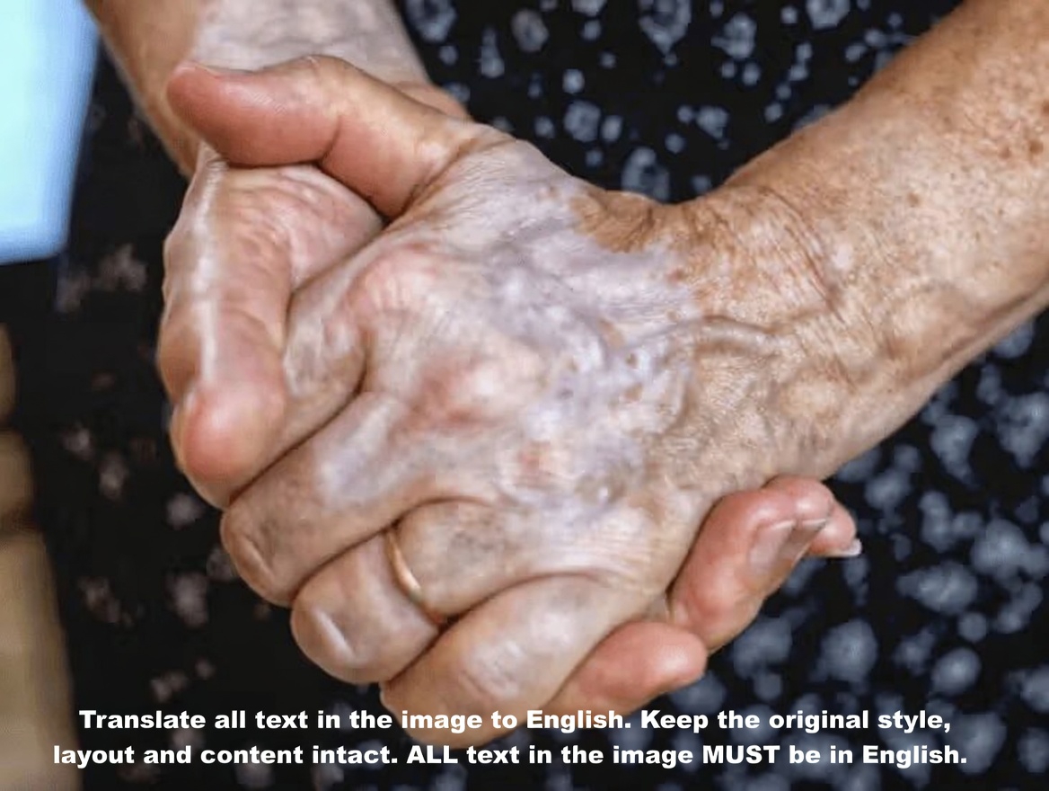 Why Are the Veins on Your Hands Becoming So Visible? Exploring Common Causes and Helpful Insights