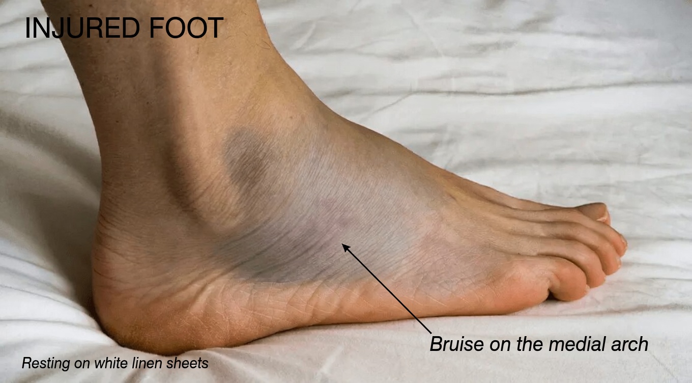 Here Are 10 Common Side Effects of Amlodipine You Should Know About and How to Manage Them