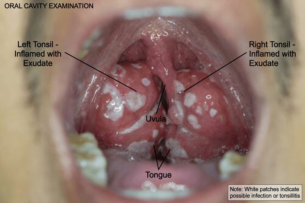 Here’s the Nasty Truth About Tonsil Stones and Simple Daily Habits to Know