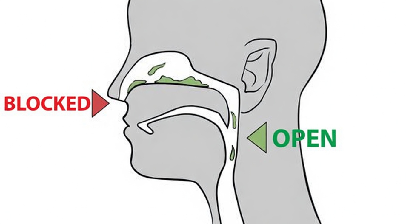 Why Do You Have Excess Phlegm in Your Throat? Key Causes and Everyday Home Tips to Manage It
