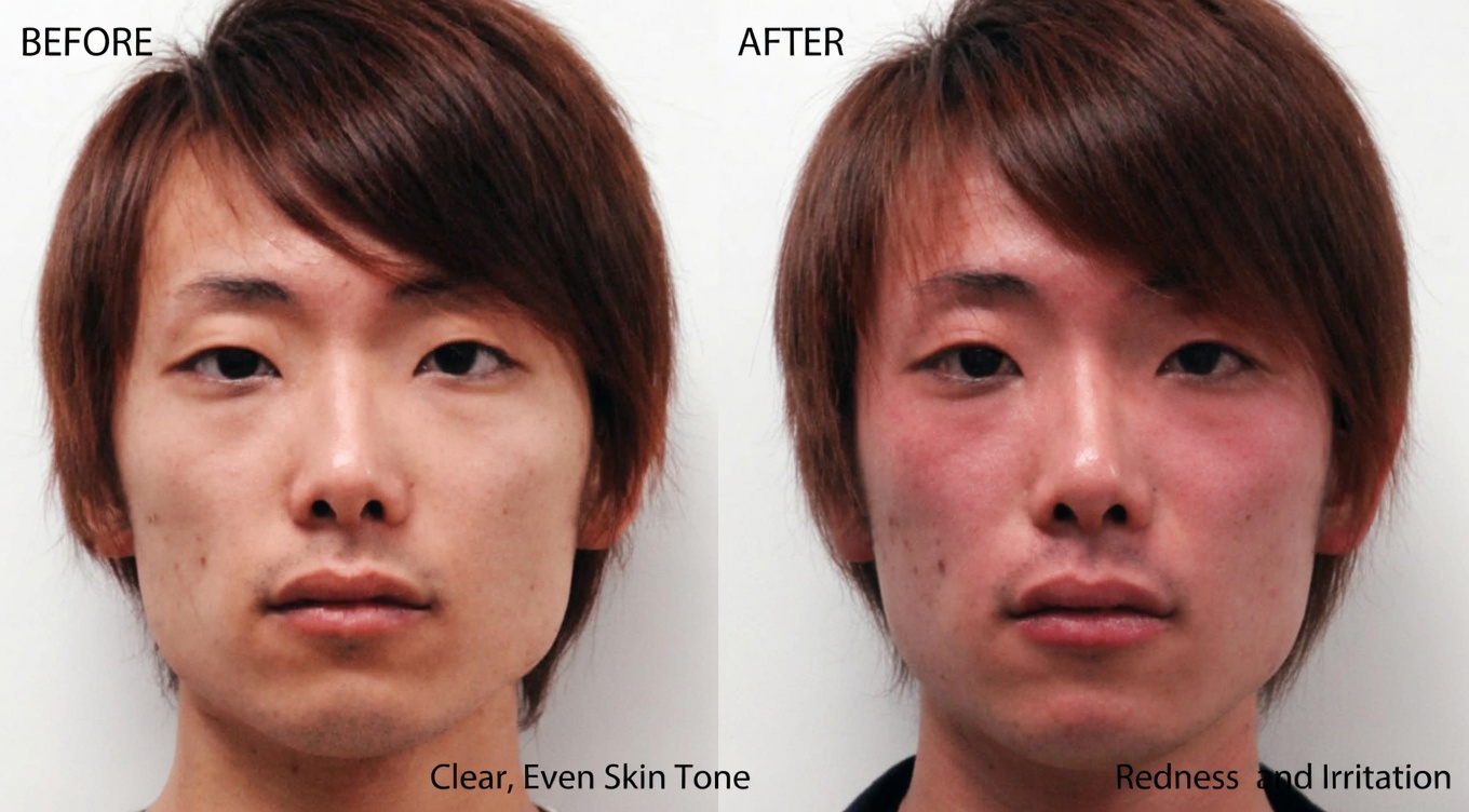 12 Amlodipine Side Effects You Need to Be Aware Of – A Complete Guide for Users