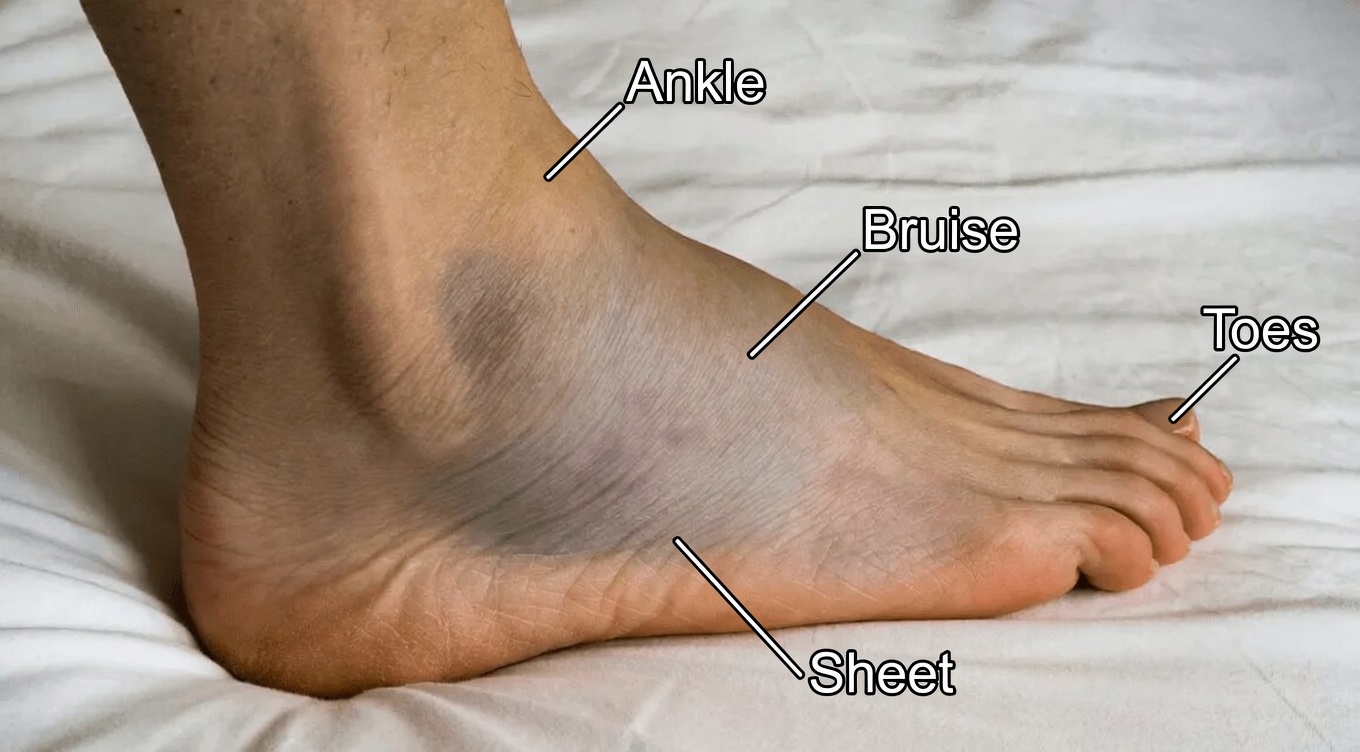 10 Common Amlodipine Side Effects You Should Know About If You Take This Popular Blood Pressure Medication