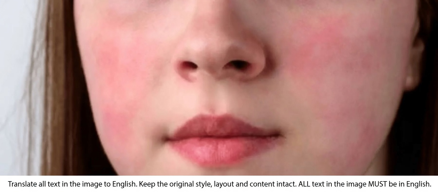 12 Common Side Effects of Amlodipine You Should Know About and How to Manage Them Safely