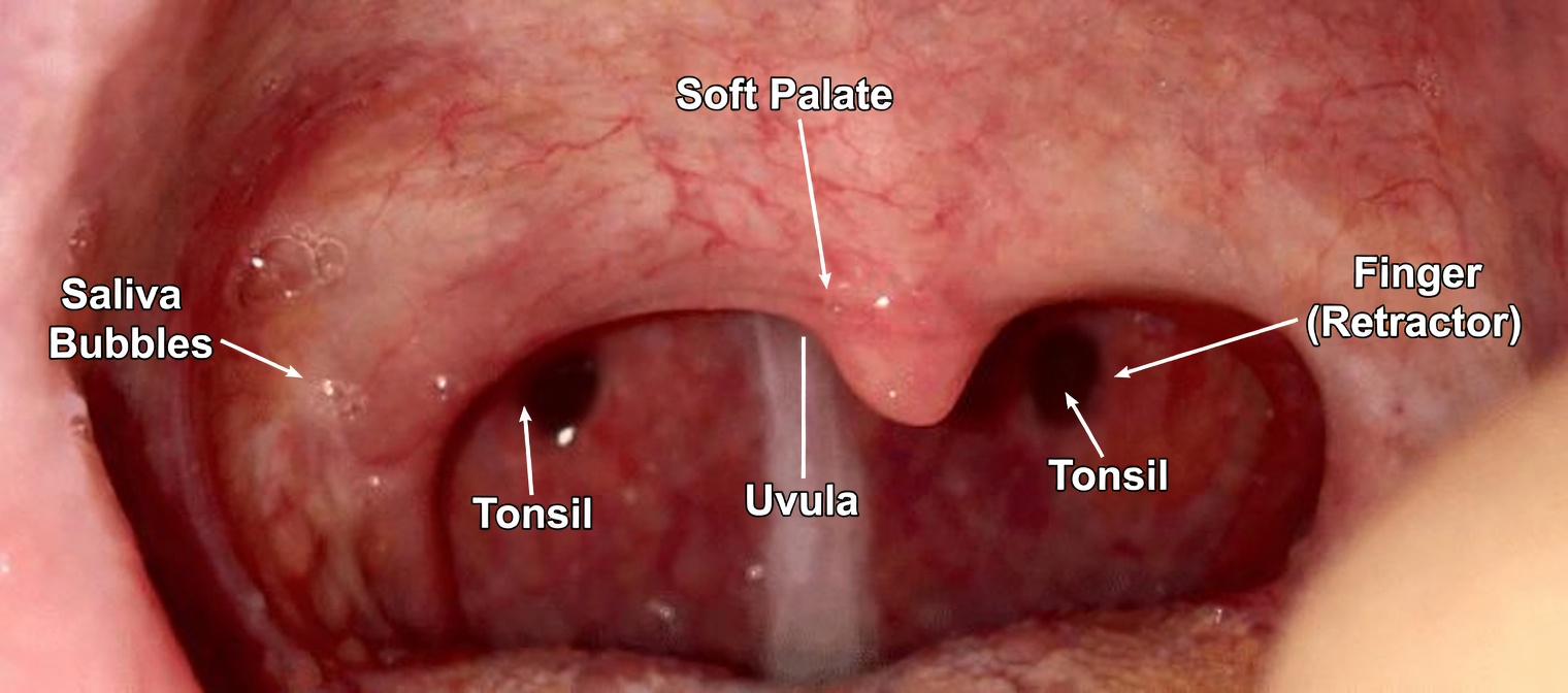 Why Do You Have Persistent Phlegm in Your Throat? The Hidden Habit Making It Worse Without You Knowing