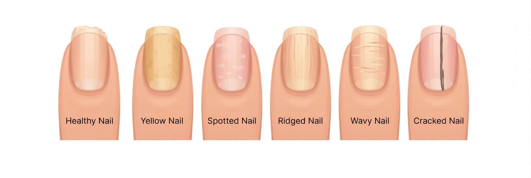Why Your Fingernails Can Offer Clues About What’s Happening Inside
