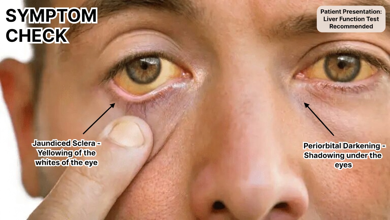 8 Strange Signs Your Body Is Begging for Vitamin B12 You Should Recognize Right Away