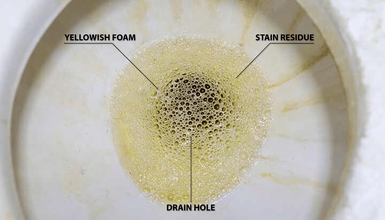 Discover 7 Strange Signs Your Kidneys May Be Quietly Asking for Help That Most People Overlook