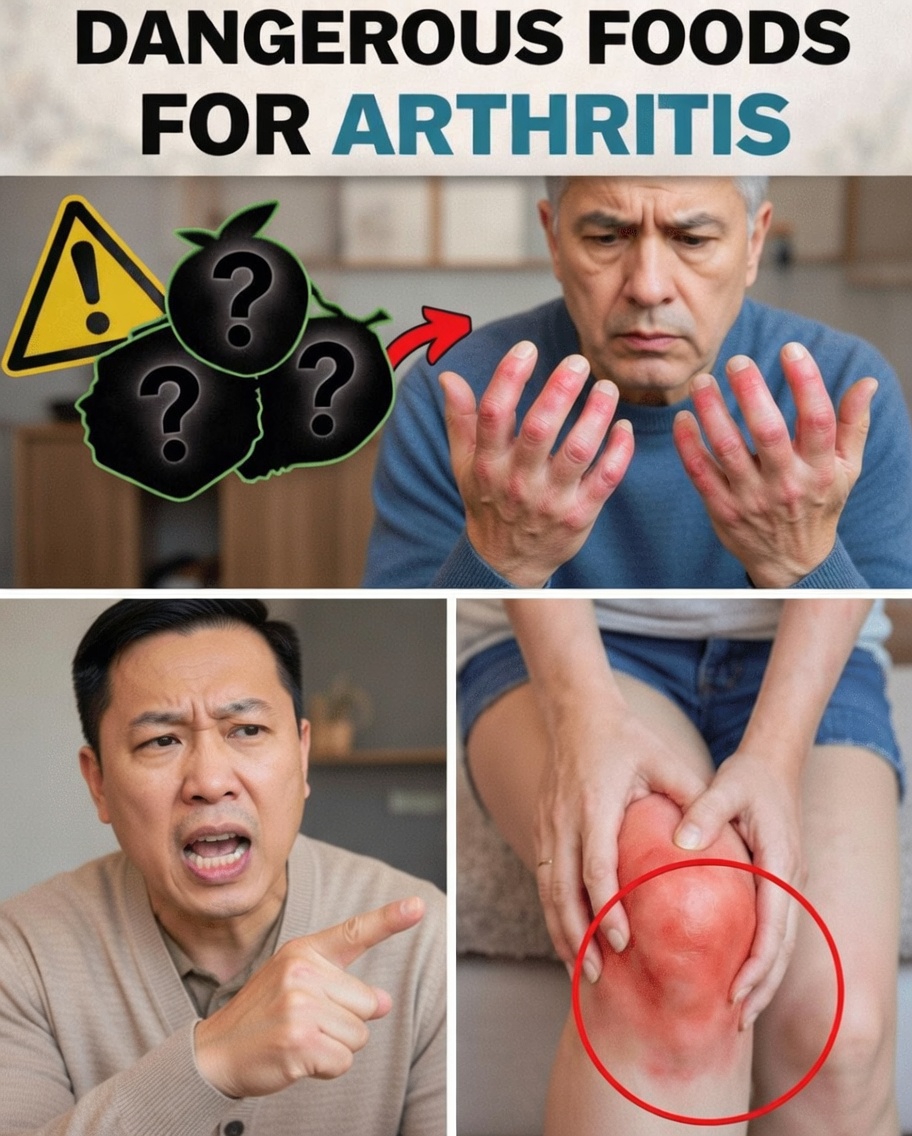 The Worst Foods for Arthritis That May Contribute to Inflammation – And Helpful Alkaline-Forming Foods to Consider