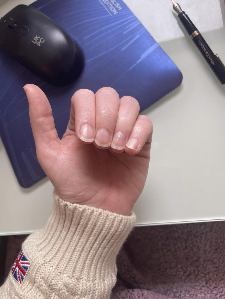 Why Do Lines Appear on Your Fingernails? What They Might Reveal About Your Health