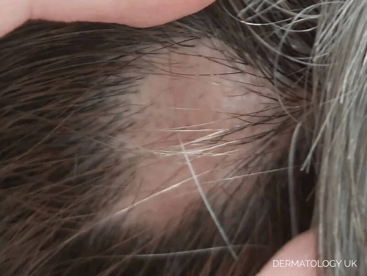 Here Are 8 Strange Signs Your Body Is Begging for Vitamin B12 That Most People Overlook Completely