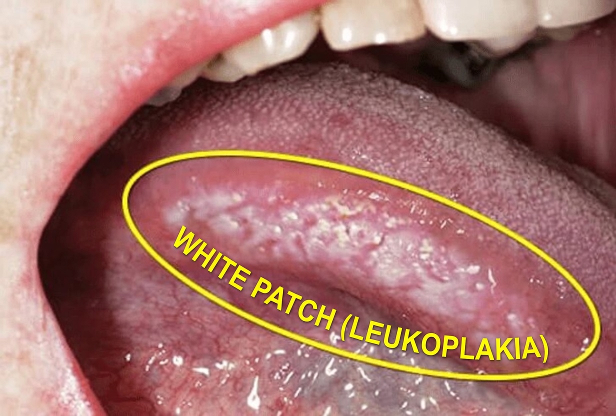 Japan’s 10-Second Tongue Reset After 60: A Quiet Habit Your Nervous System May Love