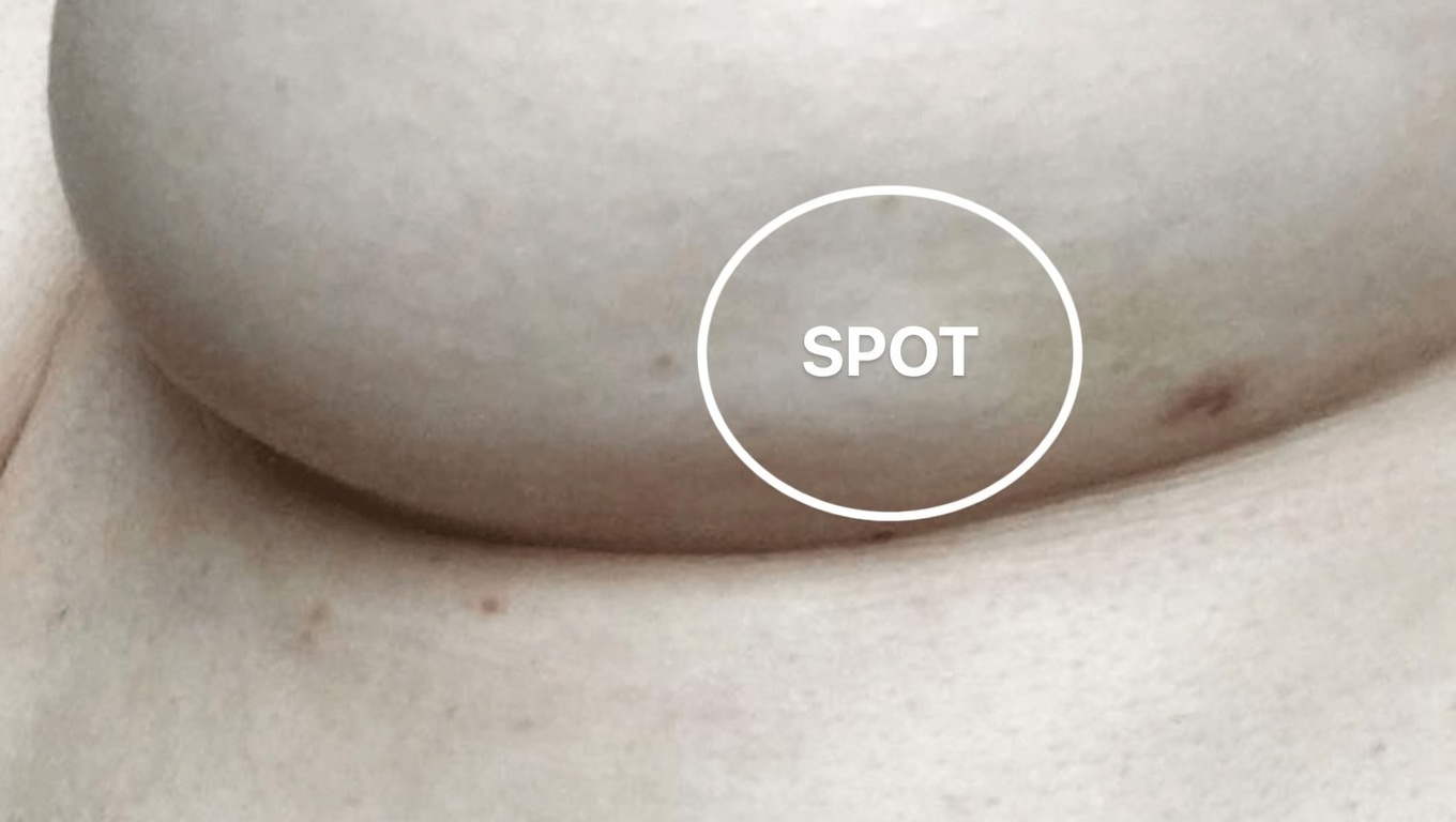 14 Visible Signs Of Cancer Most Women Ignore and What Every Woman Should Know About Them