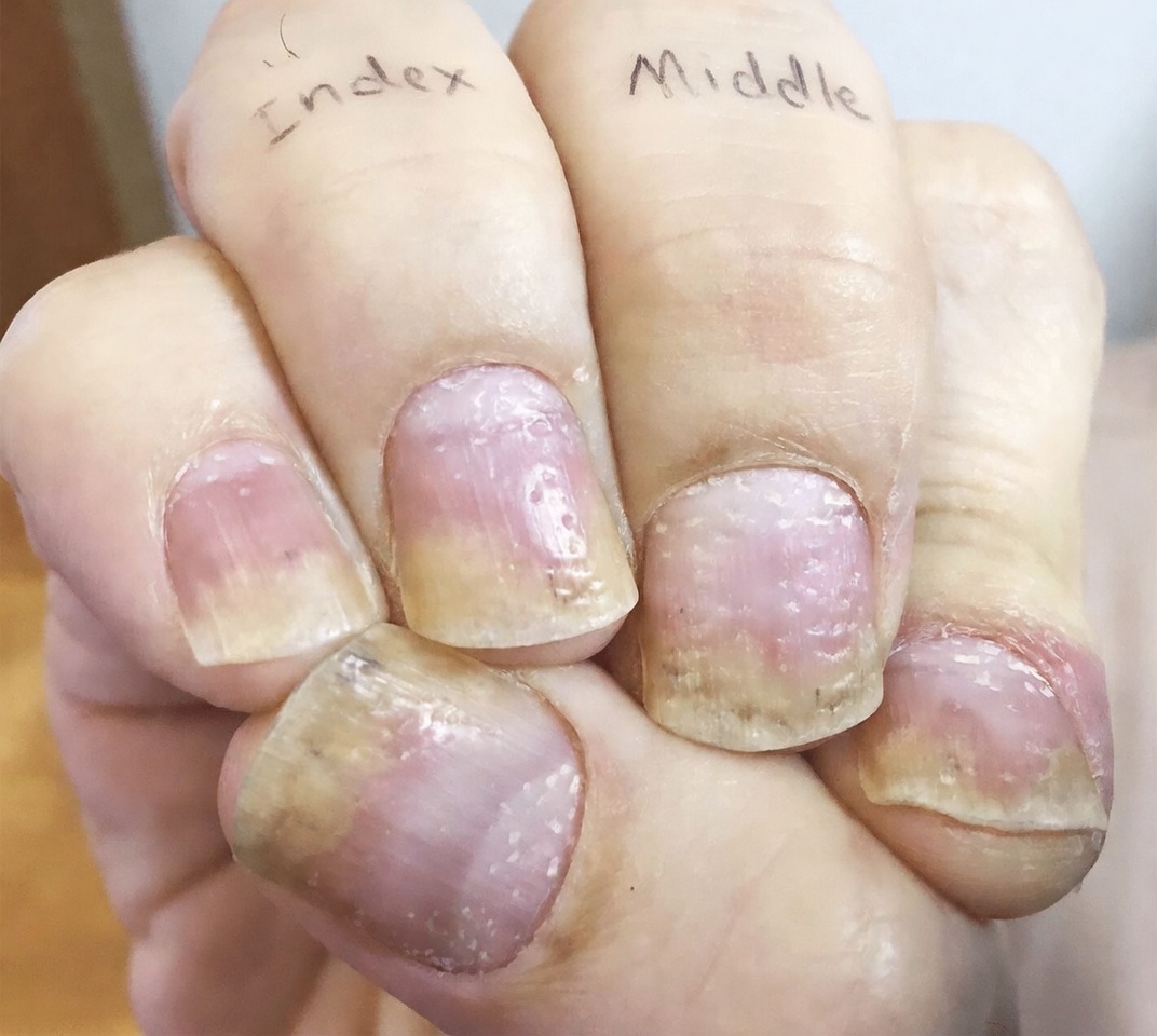 Discover Why Cloves Are Gaining Attention for Nail Health Support: Simple Recipes Benefits and Daily Habits Explained