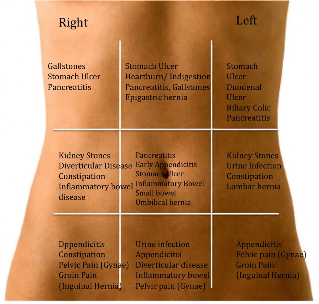 Abdominal Pain Referral Areas Explained: Your Complete Guide to Understanding Pain in Different Parts of the Abdomen