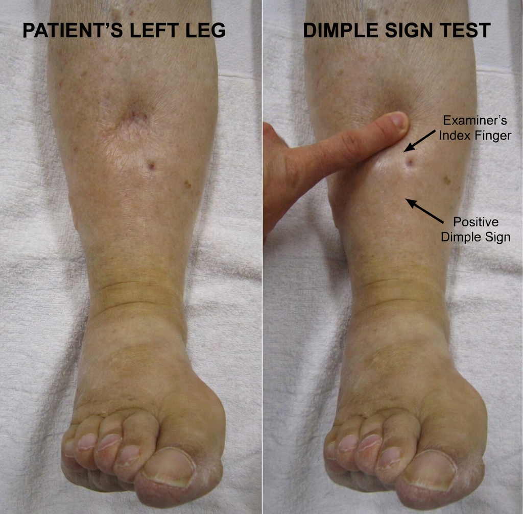 Discover 12 Amlodipine Side Effects You Should Know About and Practical Tips to Cope With Them