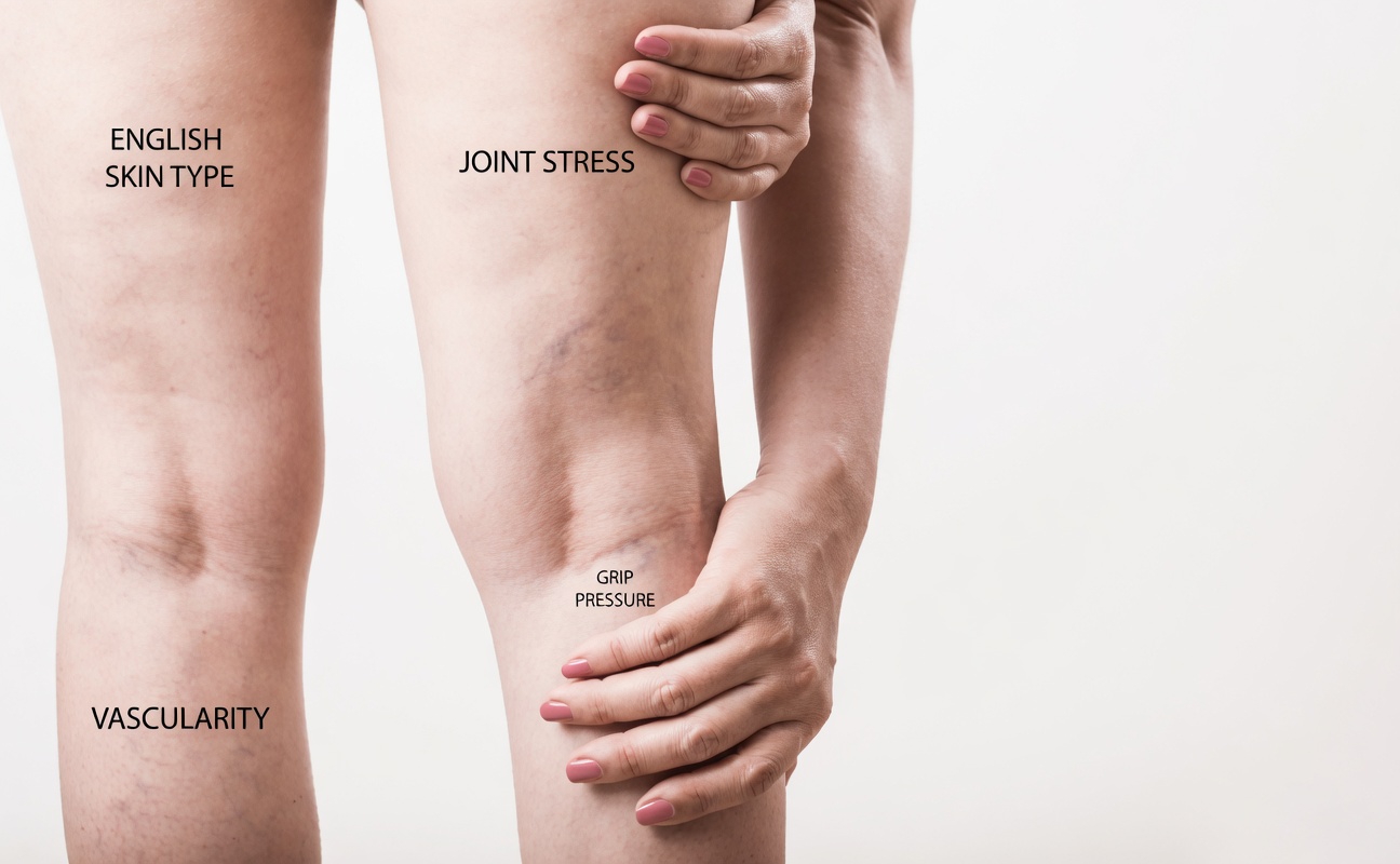 How to Recognize Leg Symptoms That Might Indicate a Higher Risk of Stroke in Older Adults