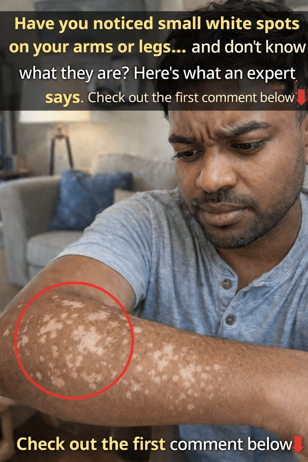 Why Do White Spots Appear on Your Arms and Legs? Understanding Common Causes and Skin Care Tips