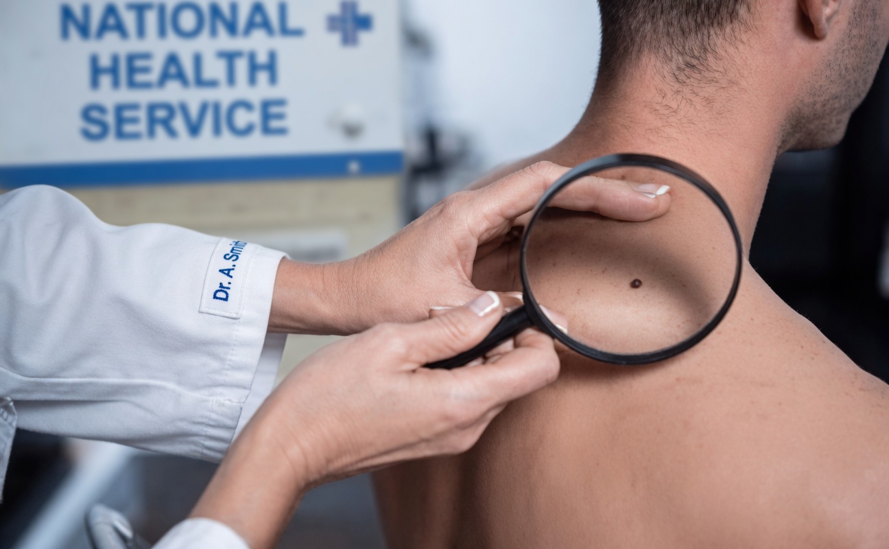 13 Early Silent Signs of Prostate Cancer Symptoms Men Over 50 Should Know About