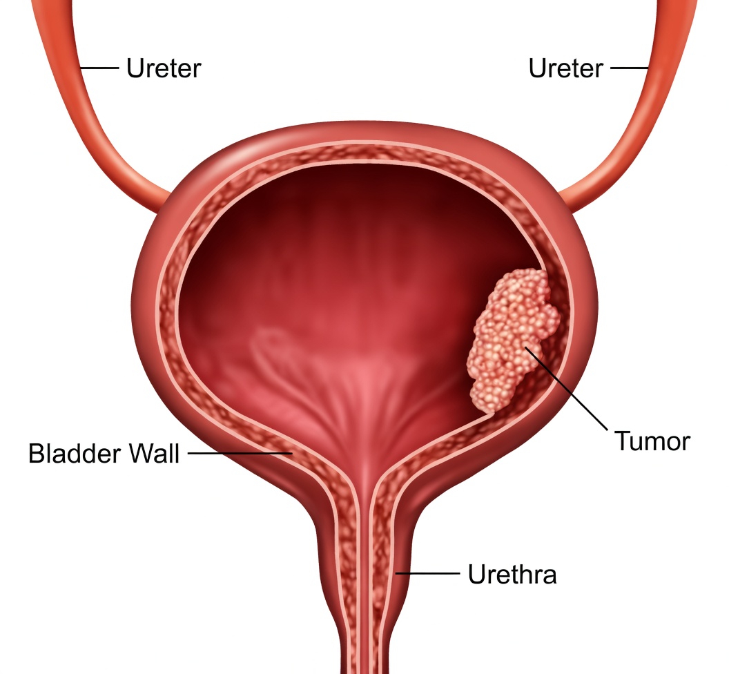 It Will Make Your Bladder and Prostate Look Like New!! The Working Grandfather’s Top Recipe