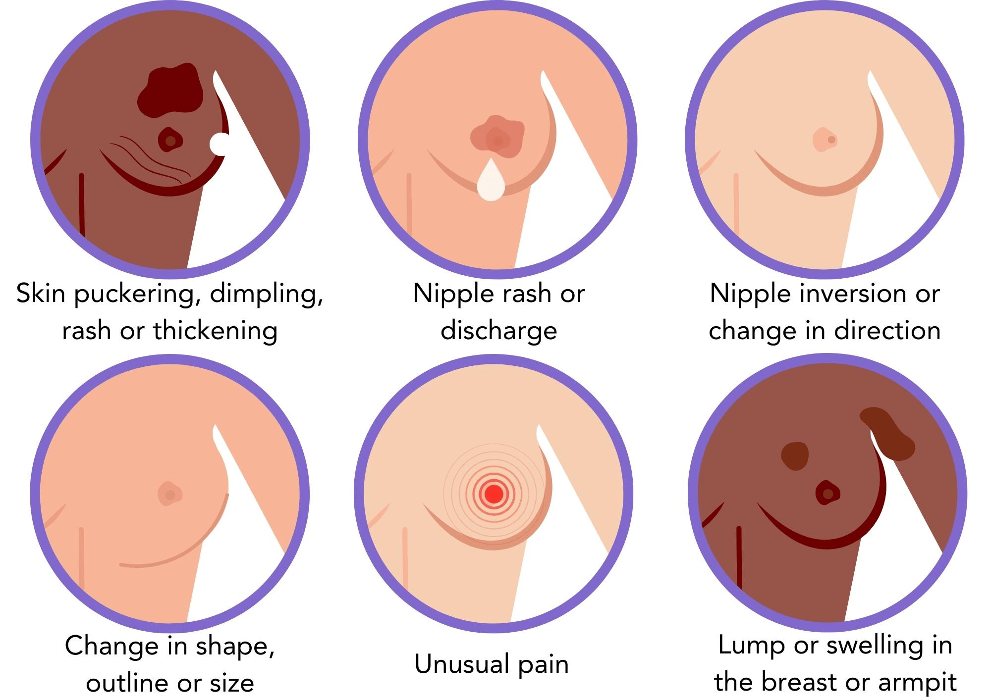 14 Visible Signs of Cancer Most Women Ignore and Why You Should Pay Attention Now