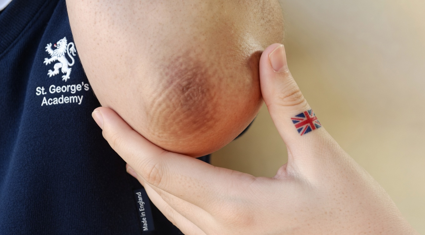 How Can You Gently Brighten Dark Elbows, Knees, and Armpits with a Simple Lemon Routine at Home?