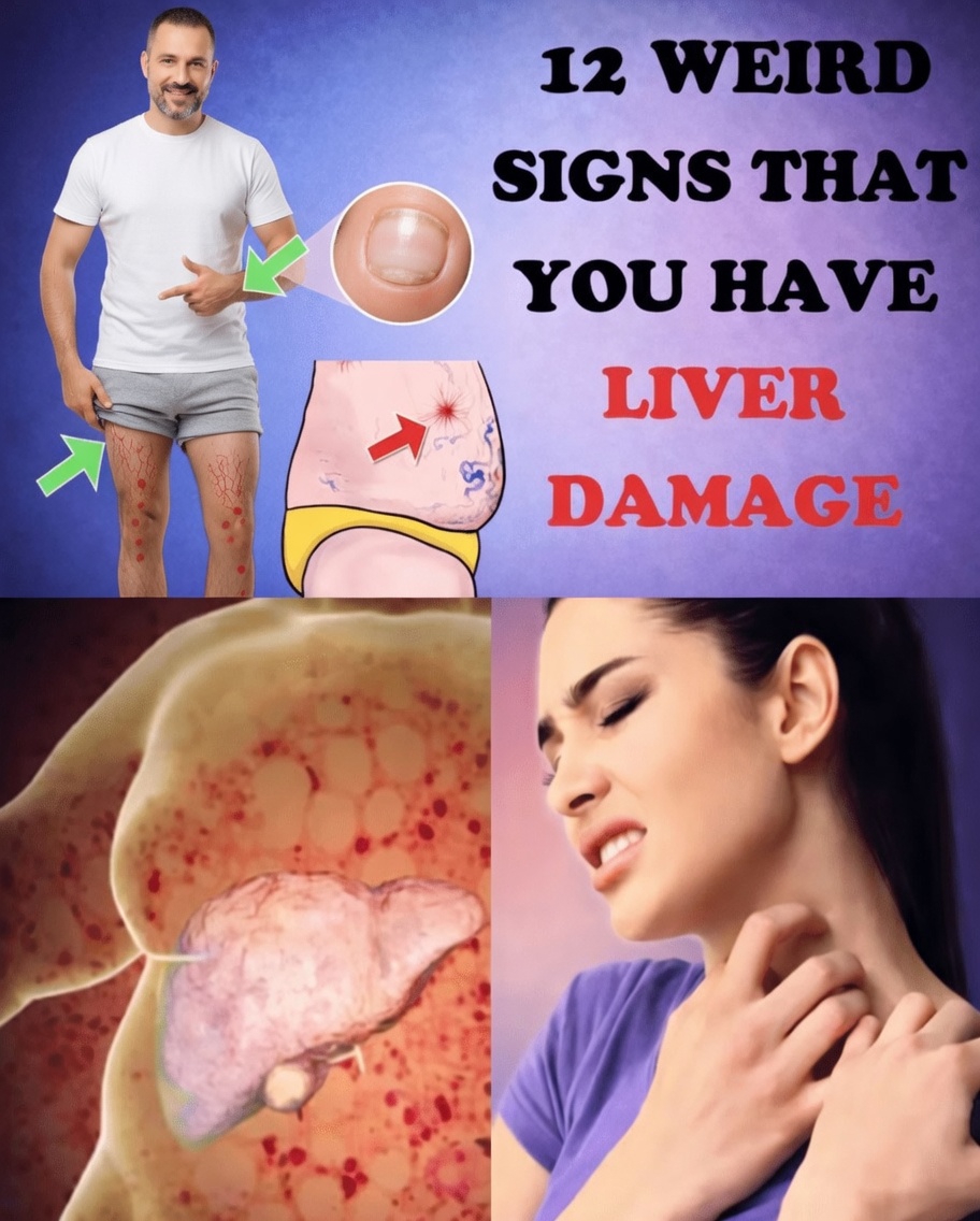 12 Unusual Warning Signs Your Liver Might Be Struggling (And Why You Shouldn’t Ignore Them)