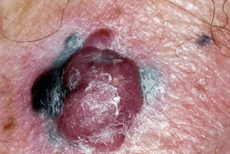 The 14 Warning Signs of Cancer You Should Never Ignore – Early Detection Could Save Your Life