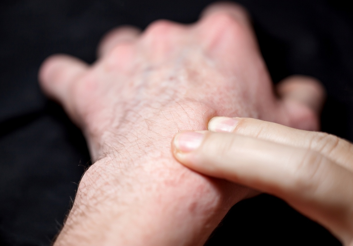 Cyst vs Lump: How to Spot the Difference and Know When It’s Time to Get It Checked