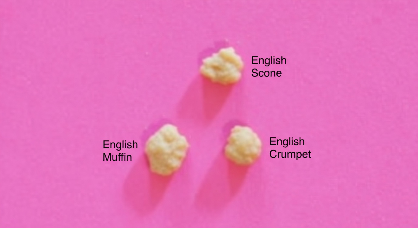 What Are Those White Stones in Your Throat That Cause Bad Breath and Discomfort?