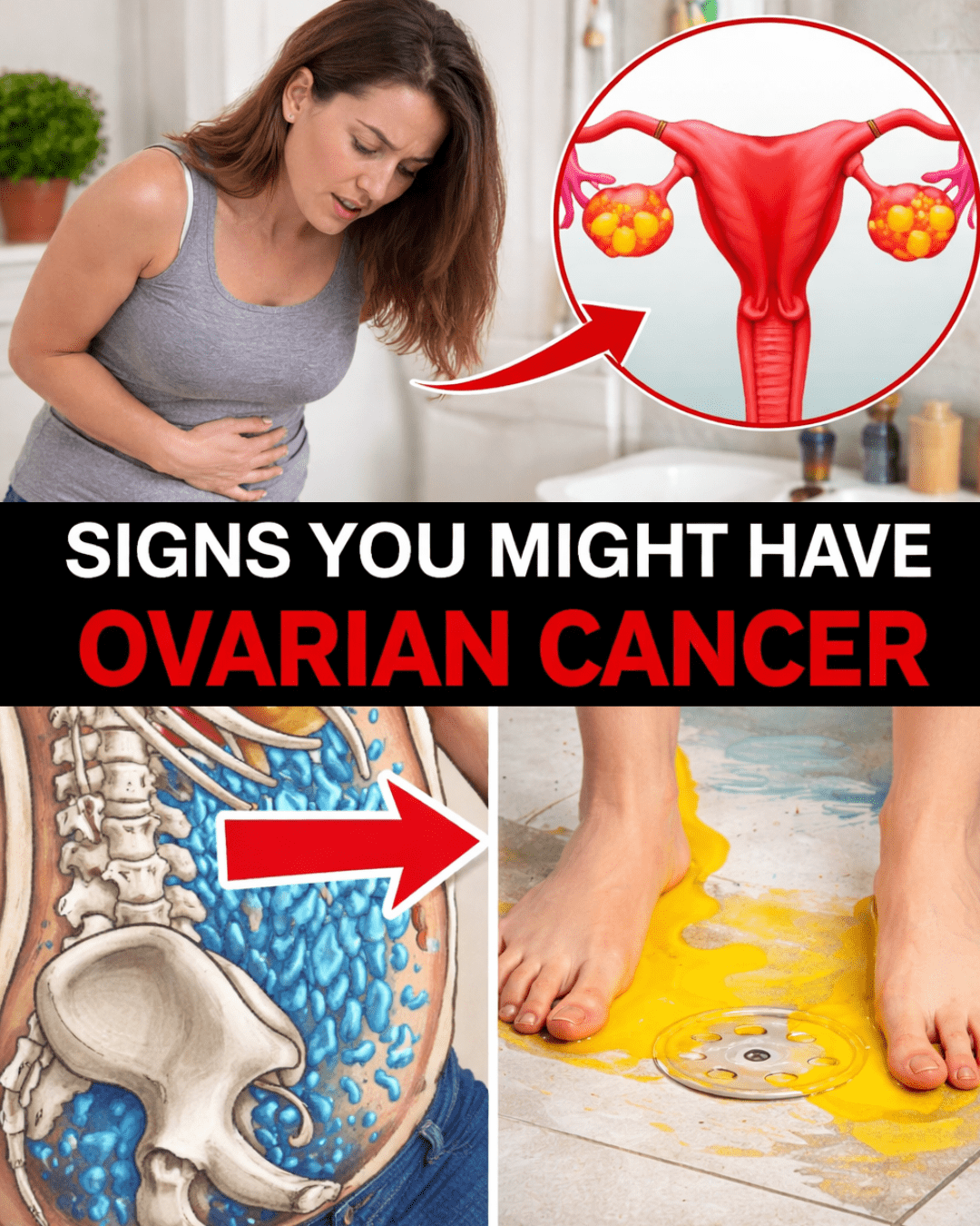 What Are the 5 Most Common Signs of Ovarian Cancer That Women Need to Know About Now