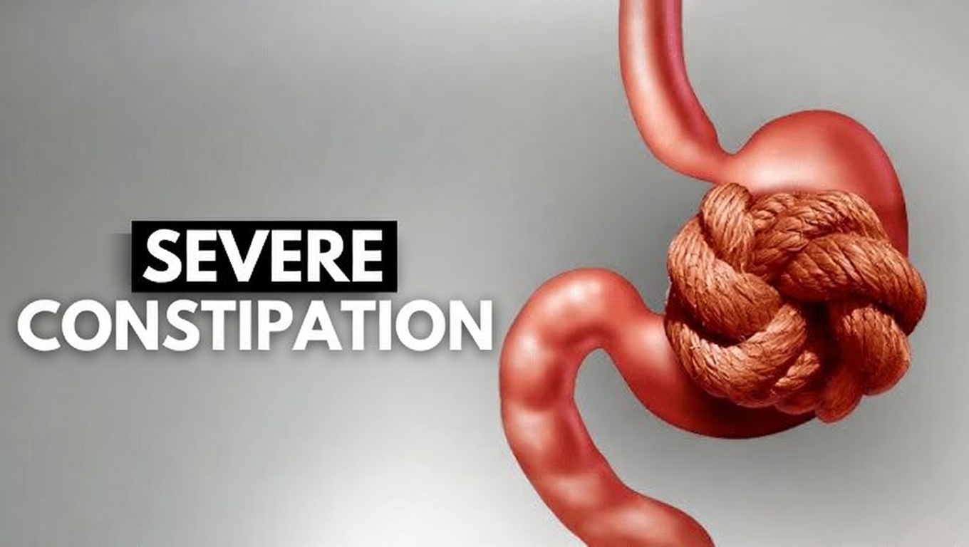 Why Does Pooping Feel Like Such a Struggle? How Your Intestines Work and Simple Habits to Support Smoother Bowel Movements