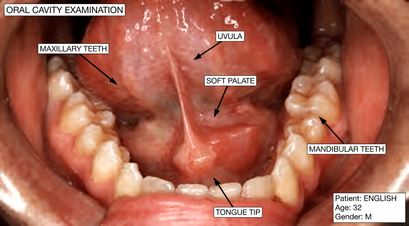Why you keep waking up with dry mouth—and what it may be telling you