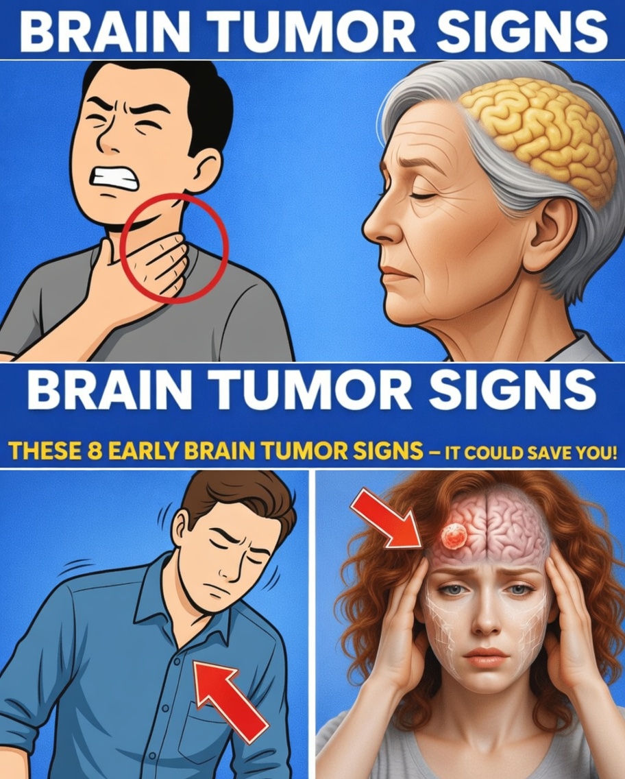 Don’t Miss These 8 Early Signs of a Brain Tumor – Early Detection Can Make a Difference