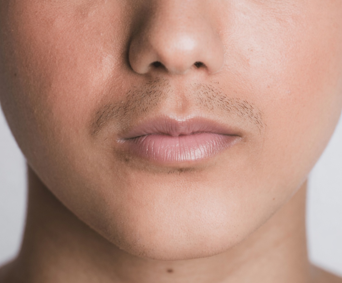 10 Smart Ways Women Over 40 Can Use Vaseline for Wrinkles to Help Support Smoother and More Hydrated Skin (You’re Applying It Wrong!)