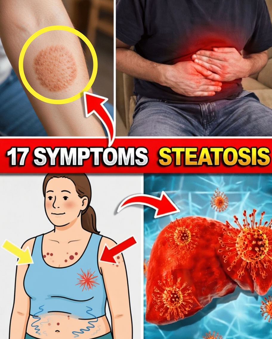 Is Your Liver Dying? 17 Critical Symptoms You Must Know! | Healthy Care