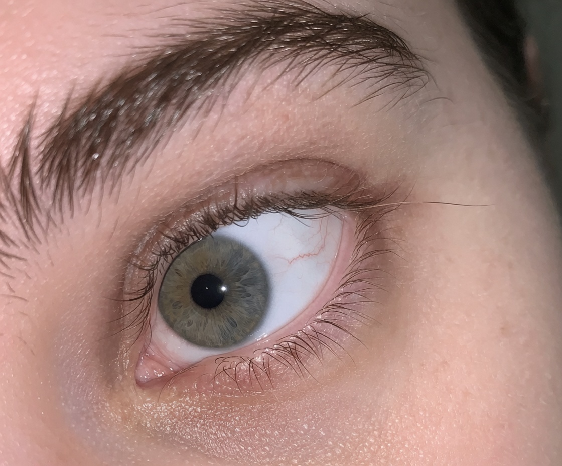 Learn About 8 Imperceptible Changes in Your Body That Could Be Warning of Health Problems