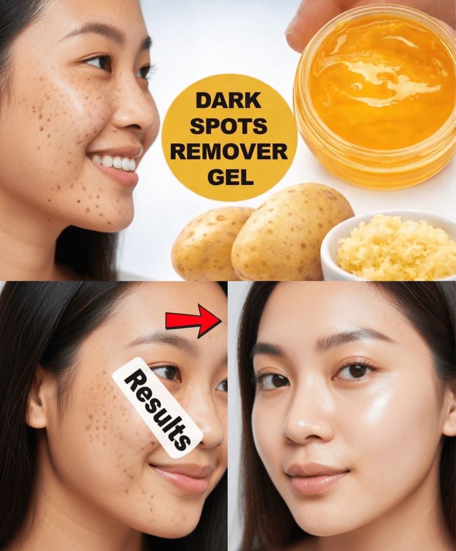 Unlock the Kitchen Secret: How Potatoes and Ginger May Support Brighter and More Even Skin Tone