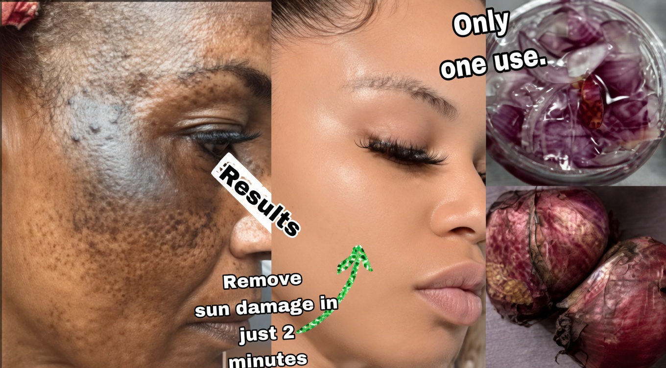 Red Onion for Face: The Natural Kitchen Trick Thousands Are Exploring for Radiant Even-Toned Skin Appearance