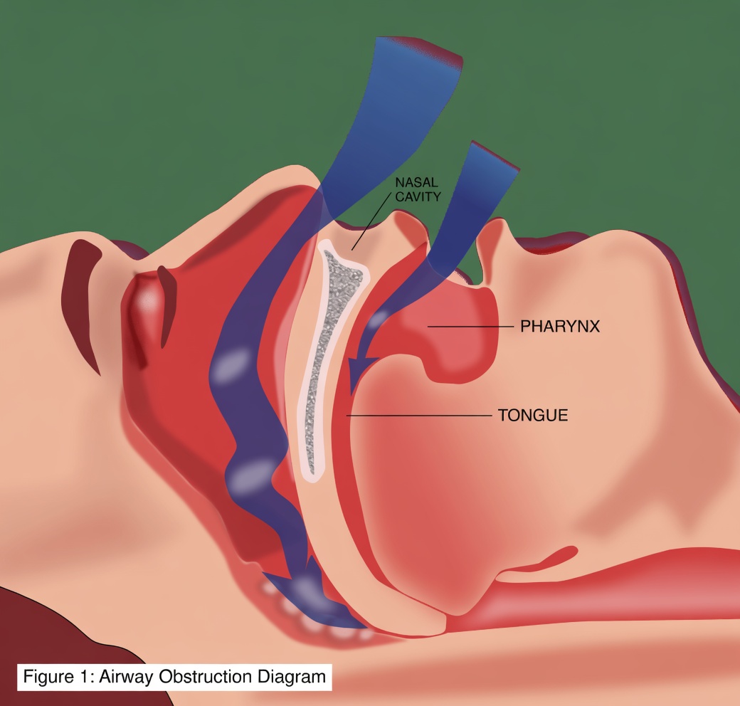 If You Drool While Sleeping, You Should Be Checked for These 8 Conditions