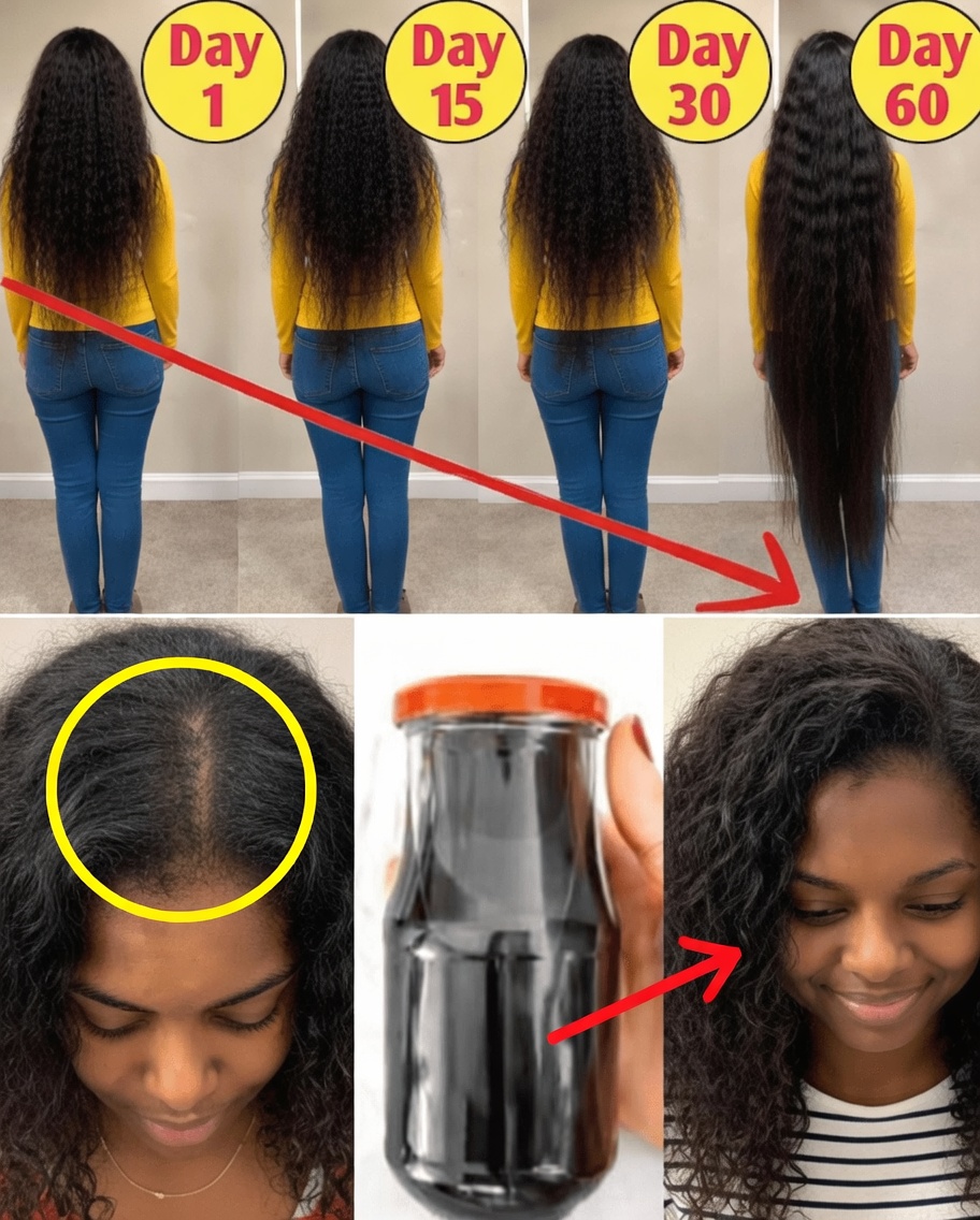 Struggling with Thinning Hair? Discover This DIY Natural Hair Growth Spray with Onion, Clove, Rosemary, and Coffee