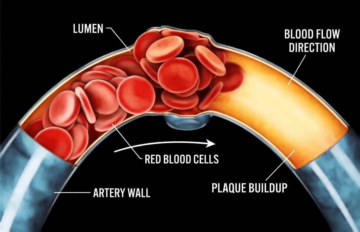 Doctors Warn: 10 Silent Signs Your Leg Arteries Are Clogged