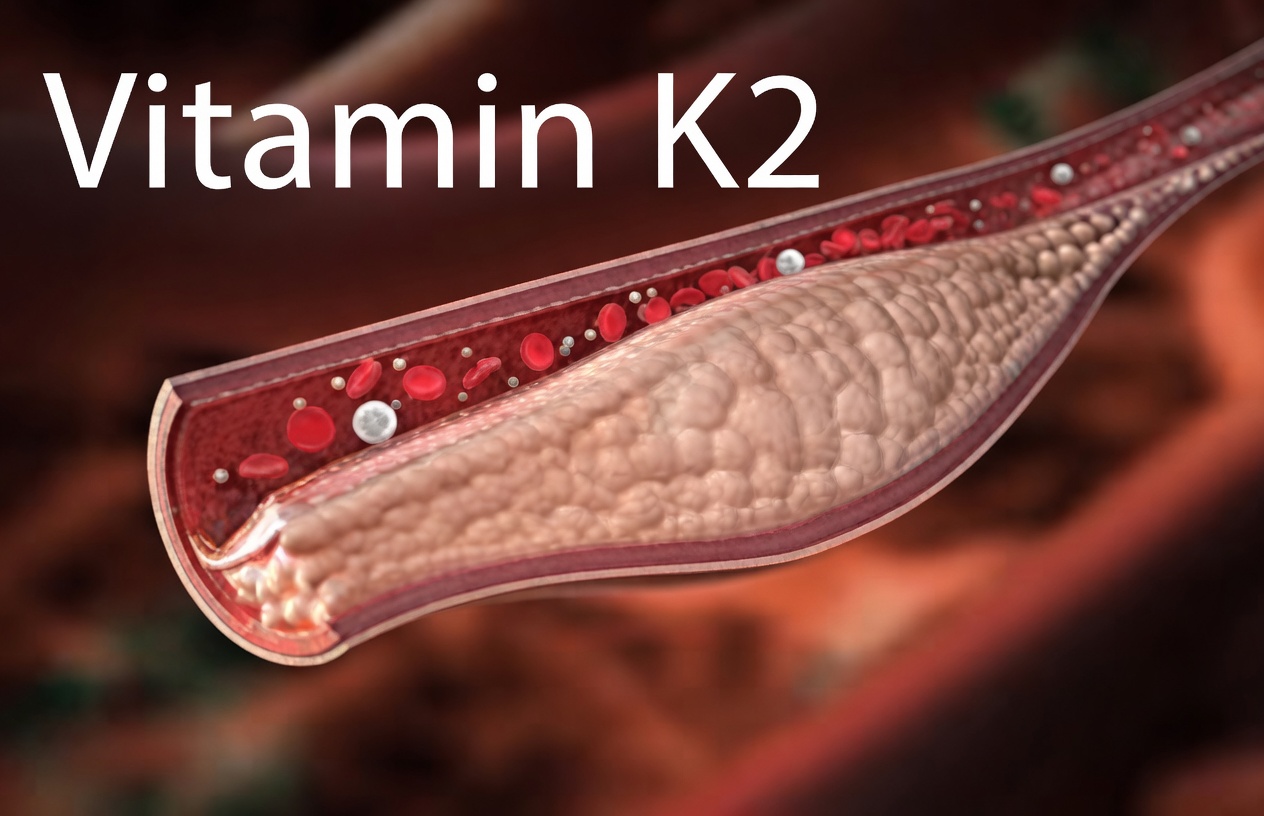 1 vitamin stops calcium buildup in arteries and heart