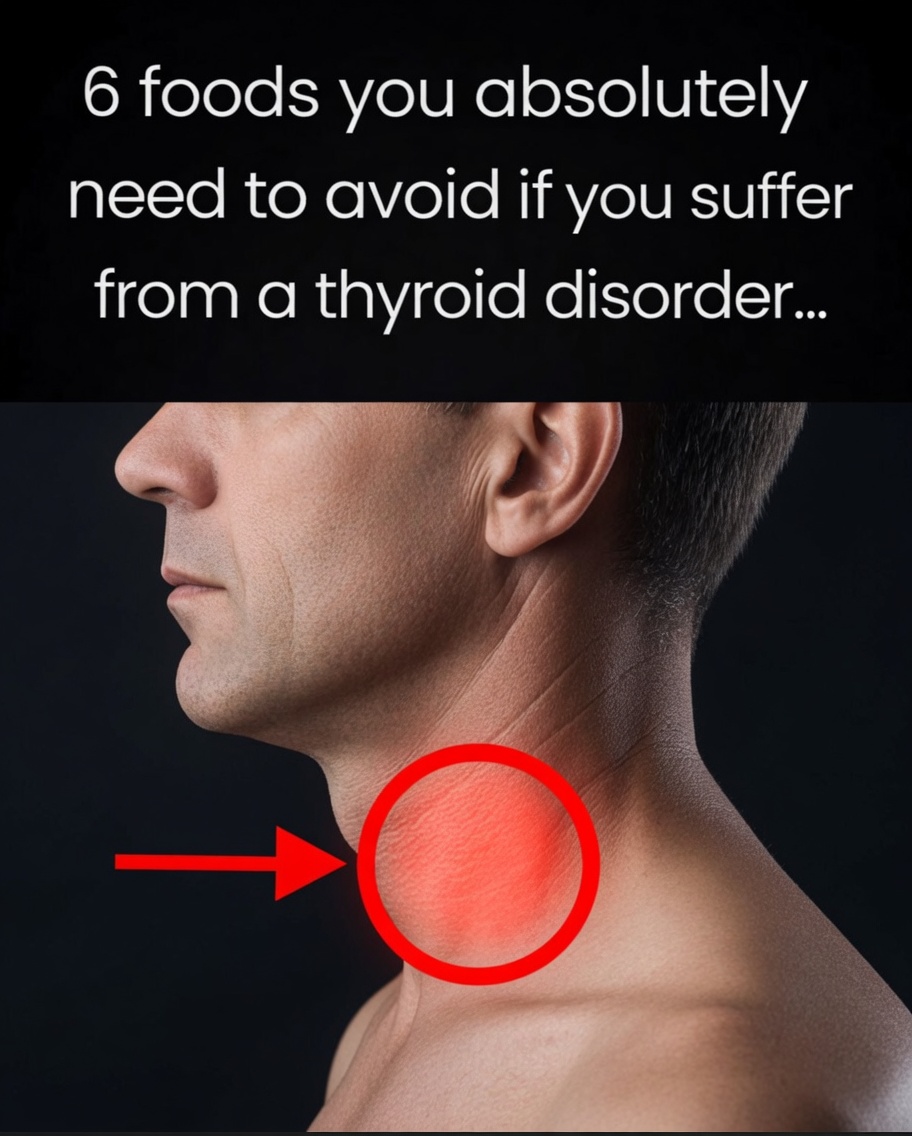 6 foods you absolutely must avoid if you suffer from a thyroid disorder