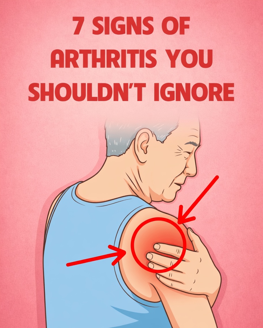 7 Signs of Arthritis You Shouldn’t Ignore