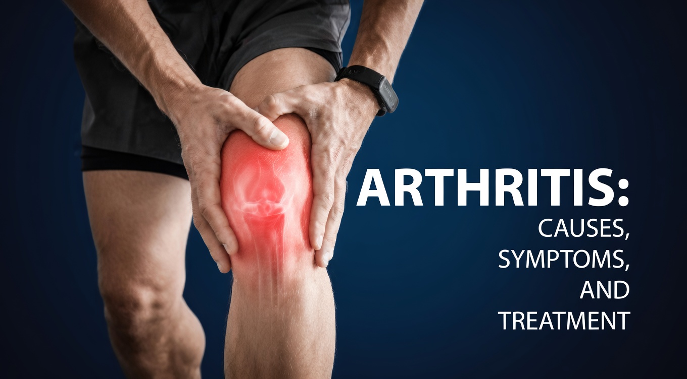 7 Signs of Arthritis You Shouldn’t Ignore